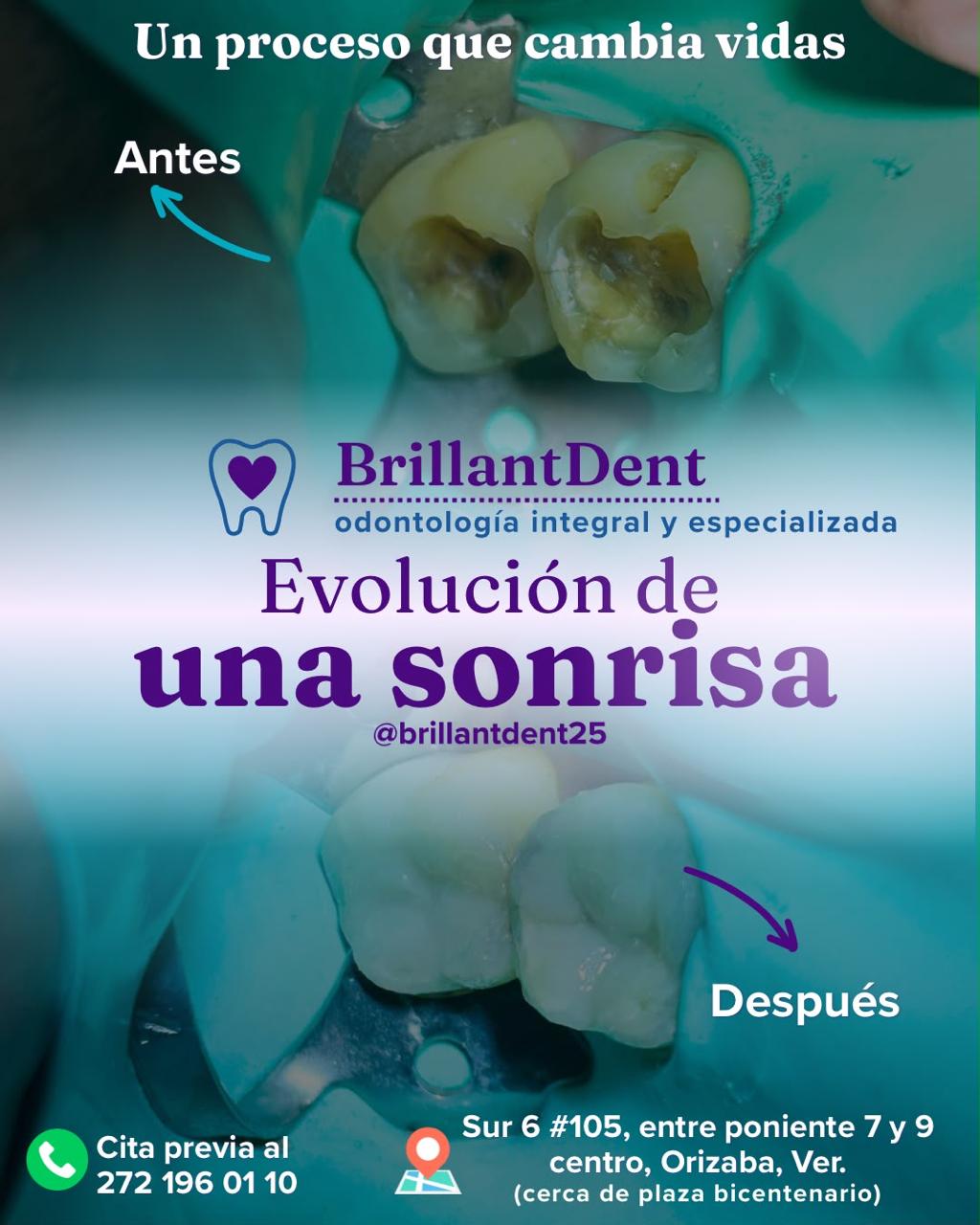 Antes y después de restauraciones con resina